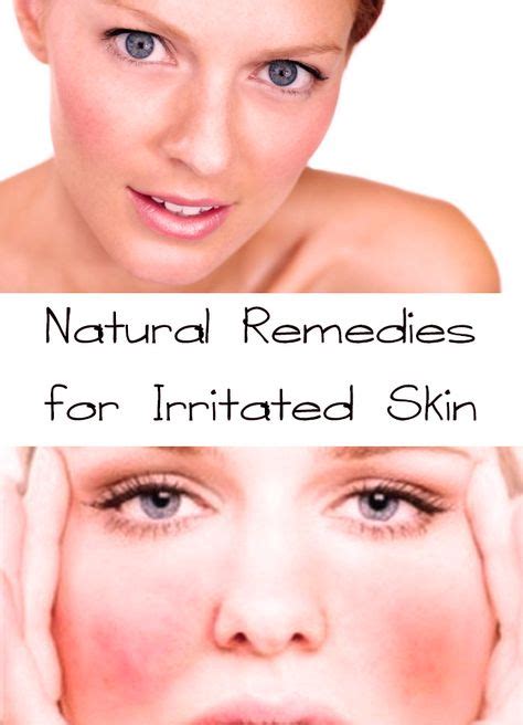 Natural Remedies For Irritated Skin Irritated Skin Skin Irritation