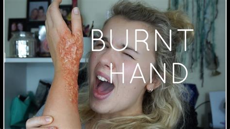 Burnt Hand Tutorial Youtube