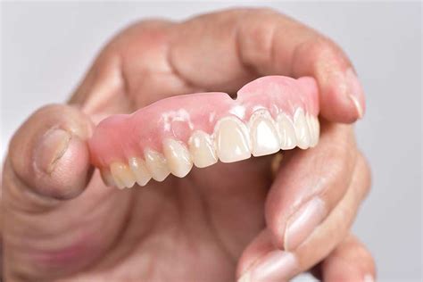Complete Dentures