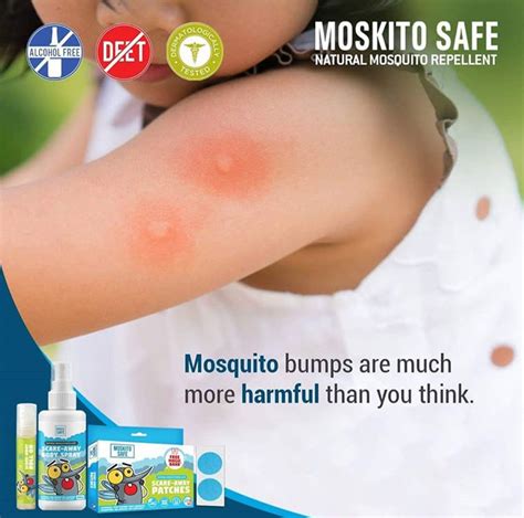 Mosquito Bumps Can Cause Itching Swelling And They Are Infectious As