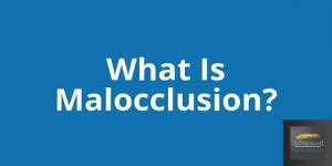 What Is Malocclusion