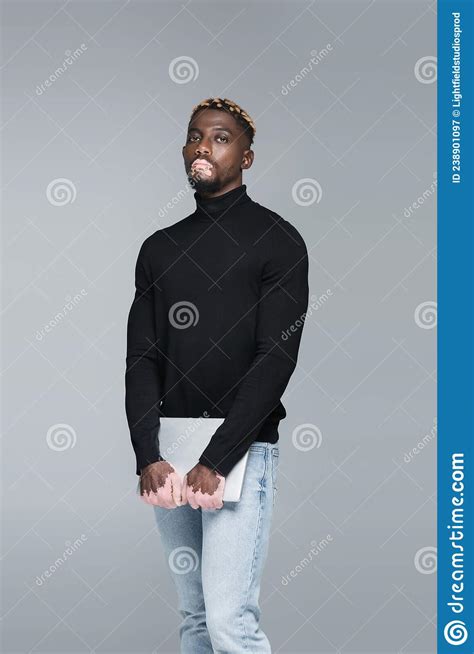 African American Man With Vitiligo And Stock Image Image Of Blogger