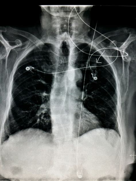 Pin On Unusual X Rays