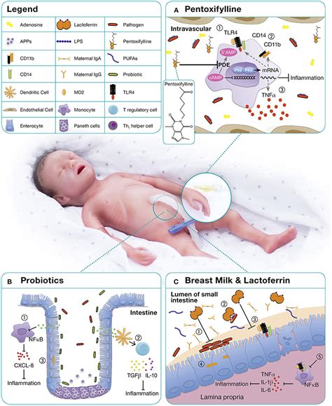 Frontiers Immunomodulation To Prevent Or Treat Neonatal Sepsis Past Present And Future