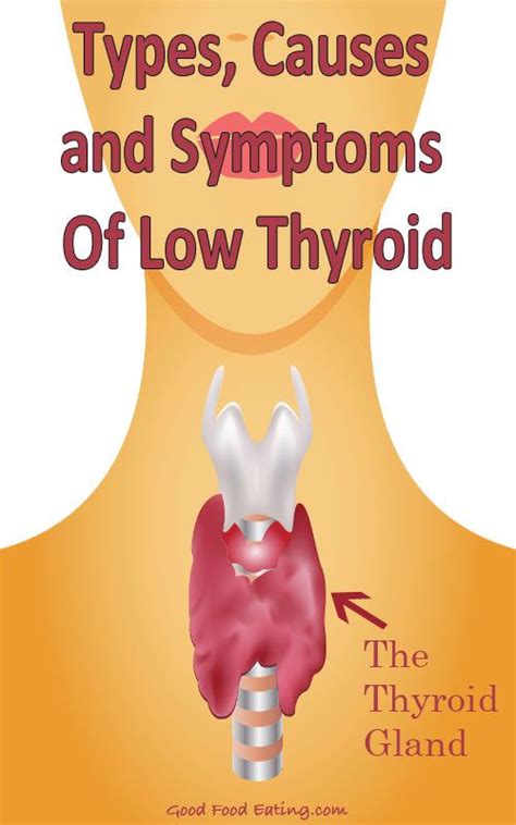 Symptoms Of Low Thyroid Low Thyroid And Thyroid On Pinterest
