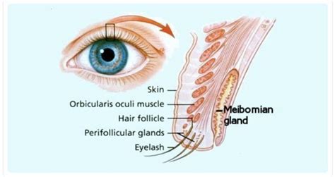 Chalazion In Upper Eyelid A Chalazion Also Known As A Meibomian Gland My XXX Hot Girl