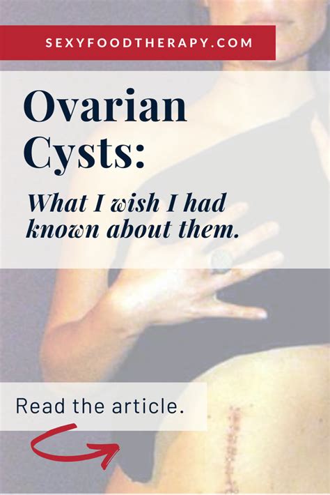 The Remedies For Ovarian Cysts I Wish I Knew About Ovarian Cyst