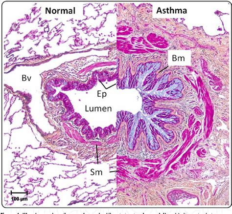 Figure 1 From IL 13 Asthma And Glycosylation In Airway Epithelial
