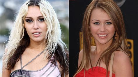 Does Miley Cyrus Have Veneers Before And After Pictures Go Viral As