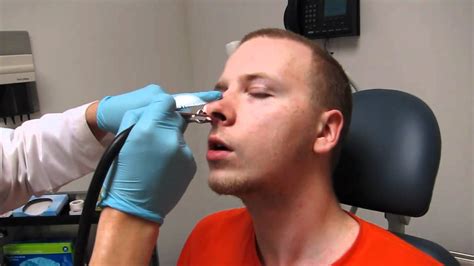 Septoplasty Nasal Splint Packing Removal And Nose Cleaning Youtube