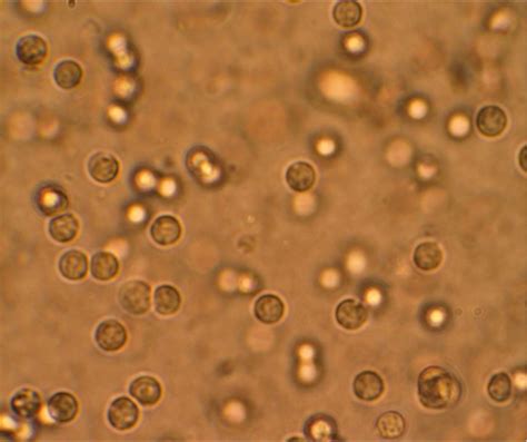 All images from the sedivue dx® urine sediment analyzer. Cells Found in Urine Sediment - Aladdin Creations