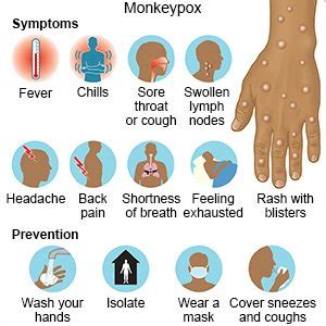 Monkeypox What You Need To Know