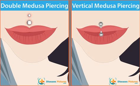 Medusa Piercing Philtrum Piercing Healing Infection Risks Pain