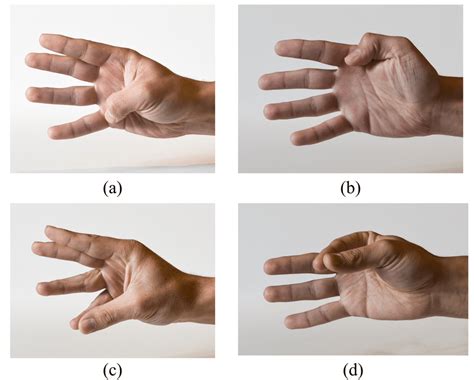 4 The Representation Of The Kapandji Test A Thumb Fingertip In