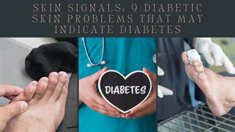 Skin Signals 9 Diabetic Skin Problems That May Indicate Diabetes
