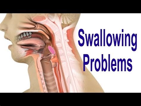 Top Causes Of Swallowing Difficulties Fauquier Ent Blog