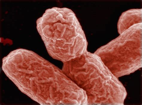 E Coli Outbreak Spreads To Seven States Without Known Cause Cdc