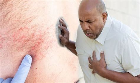 Heart Attack Seeing These Bumps On Your Body Could Mean