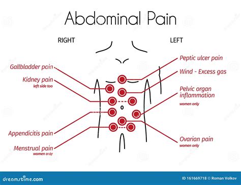 Vector Infographic Of Abdominal Pain Types Stock Vector Illustration