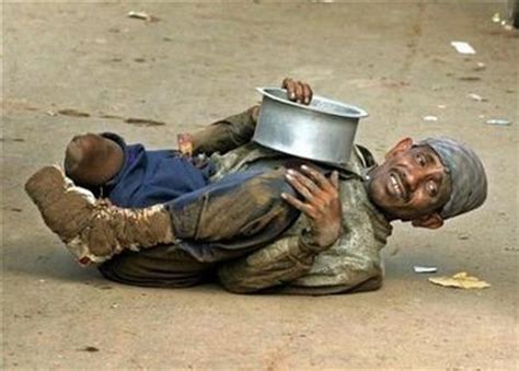 Crippled Beggars Of India Pics
