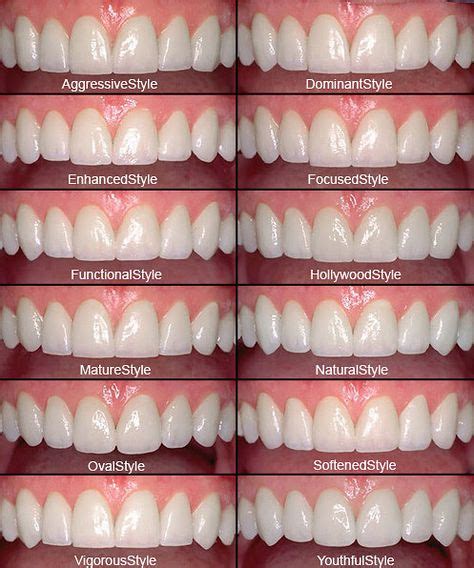 7 Best Teeth Shape Ideas Teeth Shape Teeth Beautiful Teeth