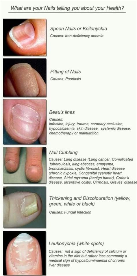 Nail Disorders A Visual Reference Table Foamed Nail Diseases And