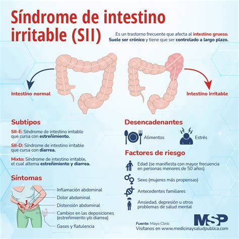 Síndrome de Intestino Irritable Infografía