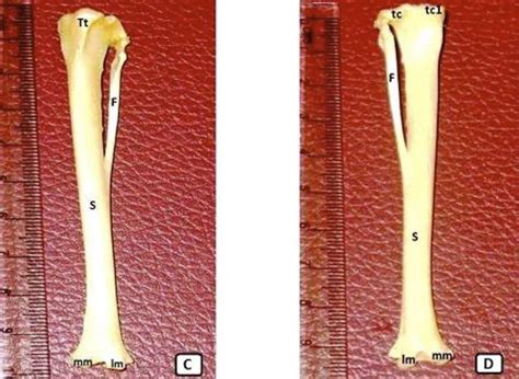 A Cranial Surface Of The Tibia B Caudal Surface Of The Tibia