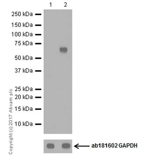 Mg 132，proteasome抑制剂 Abcam中文官网