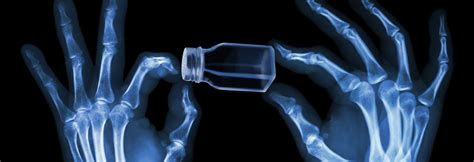 Surprise Salt Risk Weaker Bones