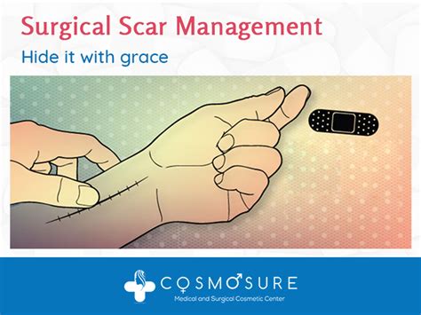 Surgical Scar Management Hide It With Grace Cosmosure Clinic