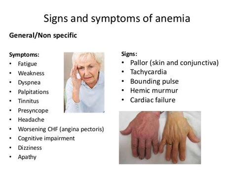 Anemia In Seniors Symptoms Causes And Treatment Elderly Care Systems