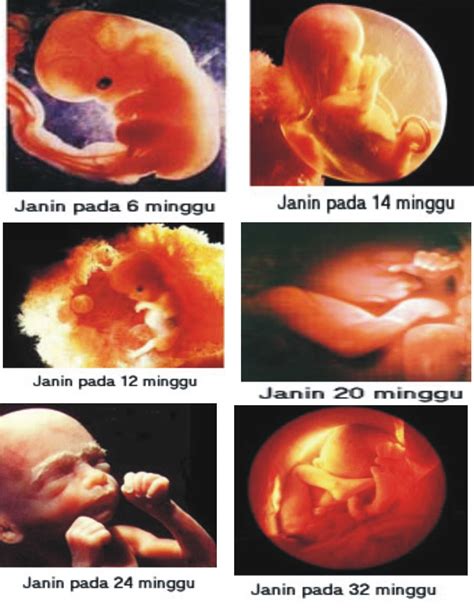 Cara mengatasi telat datang bulan agar tidak hamil. IPA: Zigot