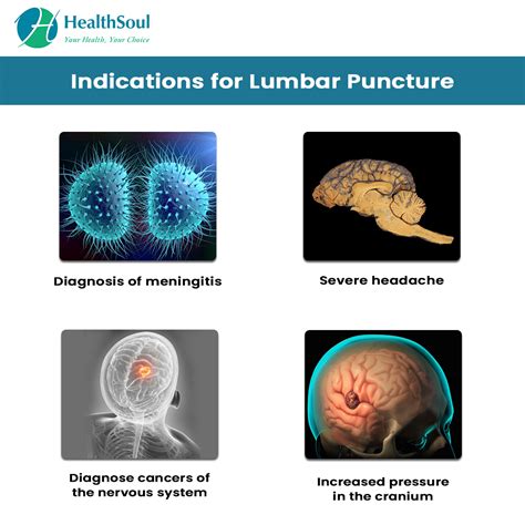 Lumbar Puncture Indications And Complications Neurology Healthsoul