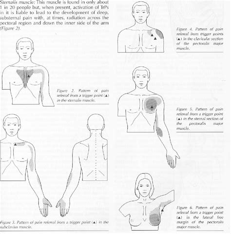 Figure 5 From Cardiac And Non Cardiac Chest Wall Pain Semantic Scholar