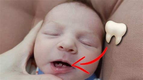 OUR NEWBORN BABY HAS TEETH Very Rare Teeth Newborn Rare Tooth