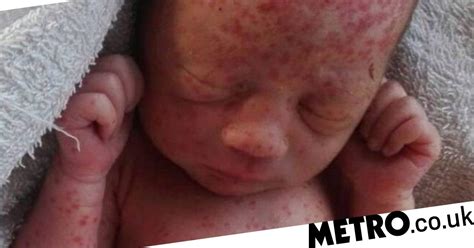 Newborn Baby Dumped In Field Found Covered In Ant And Mosquito Bites