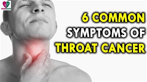 Stages Of Throat Cancer
