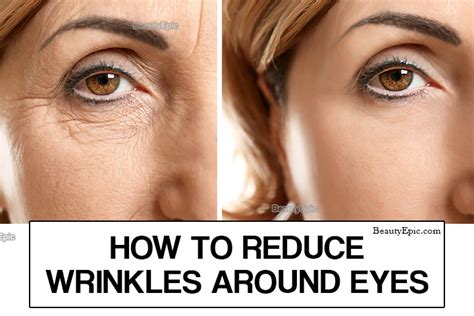 How To Get Rid Of Under Eye Wrinkles Naturally
