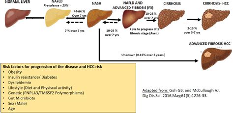 Epidemiology Of Hepatocellular Carcinoma In Metabolic Liver Disease