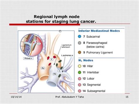 Lung Cancer Staging The Noninvasive Tools
