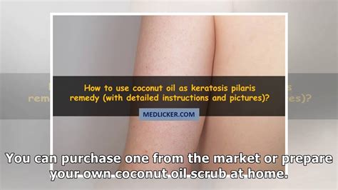 Coconut Oil For Keratosis Pilaris How To Use And Why Youtube