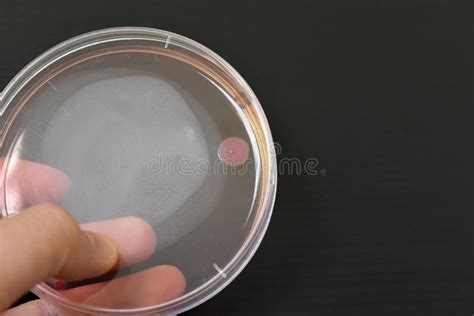 Colonies Of Bacteria Growth On Agar Plate Medium Stock Image Image Of