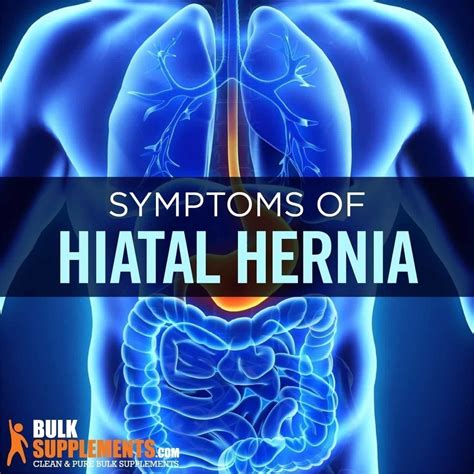 Tablo Read Hiatal Hernia Symptoms Causes And Treatment By