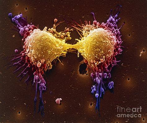 Cancer Cell Division Micrograph Wallart Sem Homedecor Cancer Cell