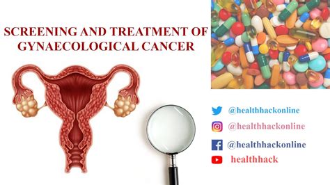Screening And Treatment Of Gynaecological Cancers Youtube