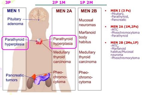 Men Syndrome Mnemonics Epomedicine