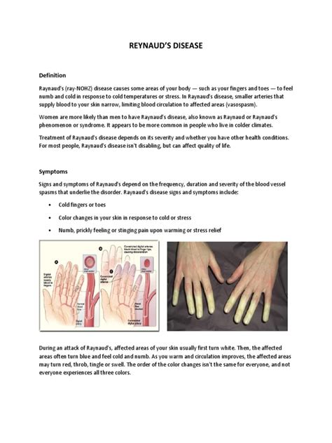 Understanding Raynauds Disease Causes Symptoms Diagnosis And Treatment Options Pdf