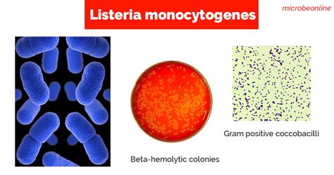 Gram stain of listeria monocytogenes (source). Listeria monocytogenes: Properties, Pathogenesis, and Lab ...