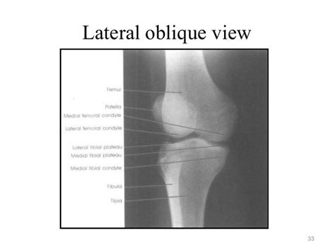 Radiographic Positioning Examples Of The Leg And Knee Ce4rt Organic